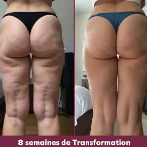 Laura (35 ans)