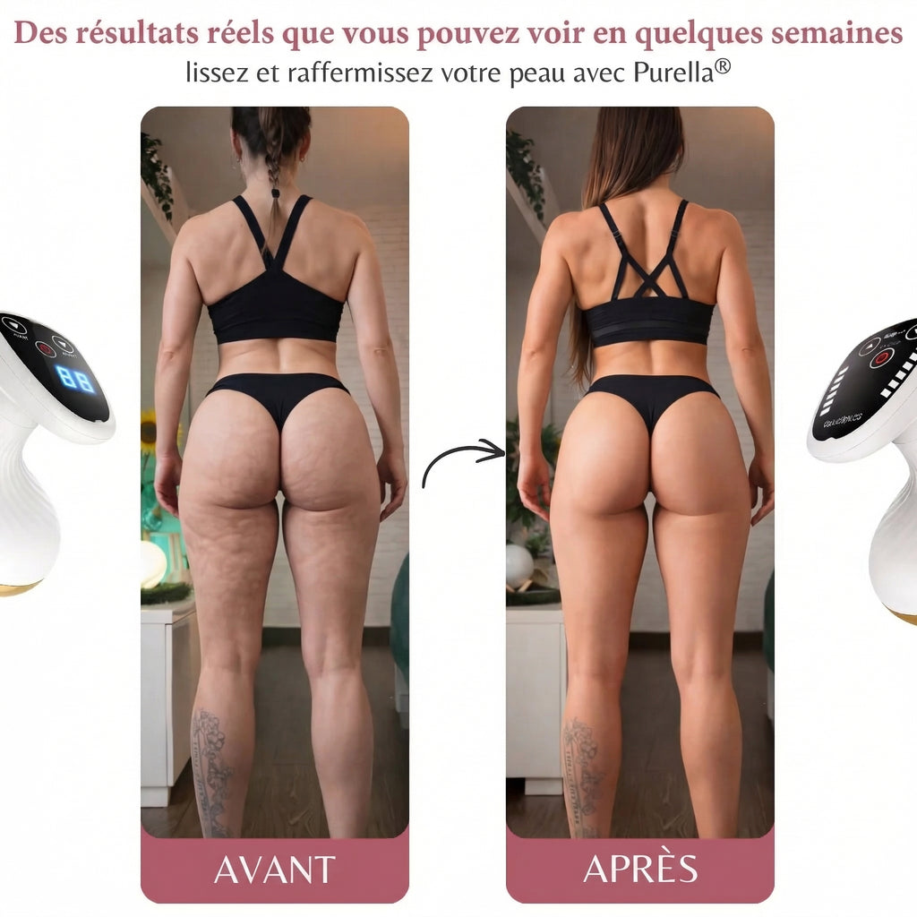 LUNEA® Masseur à Ventouses Électrique – Anti-Cellulite